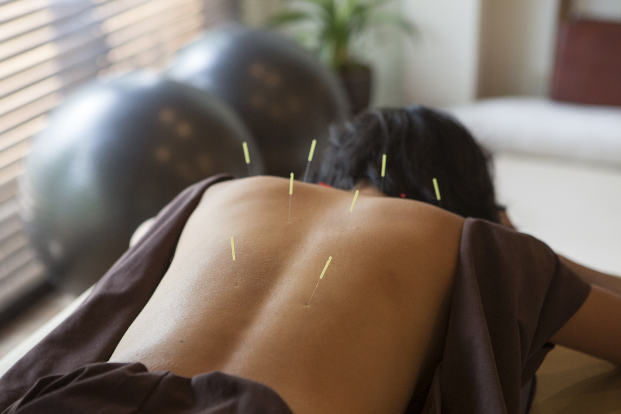 japanese female get acupuncture treatment in kyoto japan Acupuncture Appointment